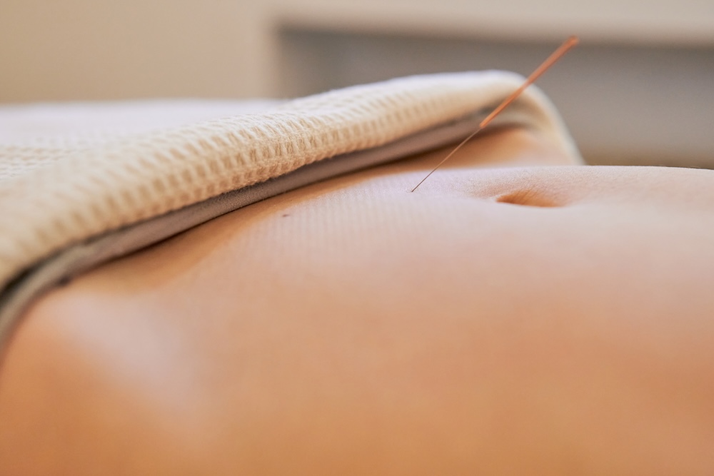 Fertility Acupuncture near Calgary - Optimum Wellness Centres