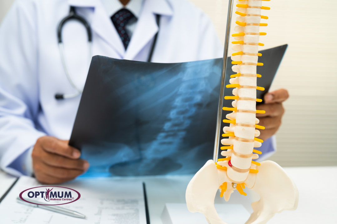 OWC Blog Post – imaging Diagnostic Imaging Options for Physiotherapy and Chiropractic Patients in Alberta