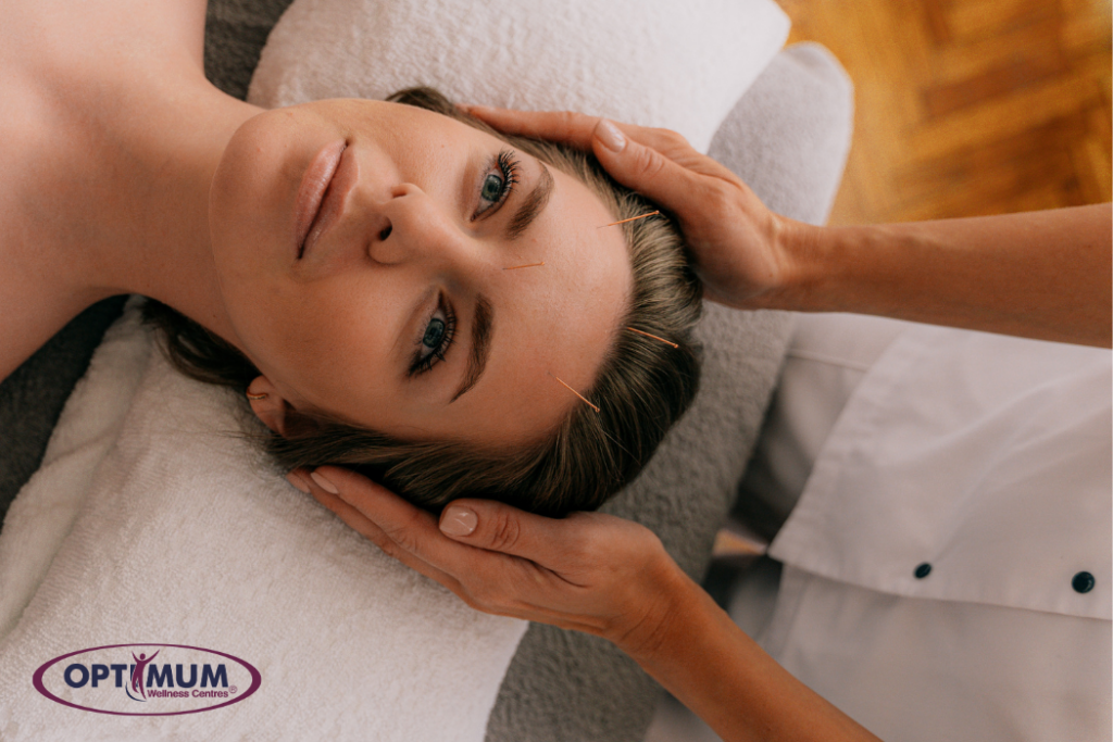 Cosmetic Acupuncture Calgary - Optimum Wellness Centres
